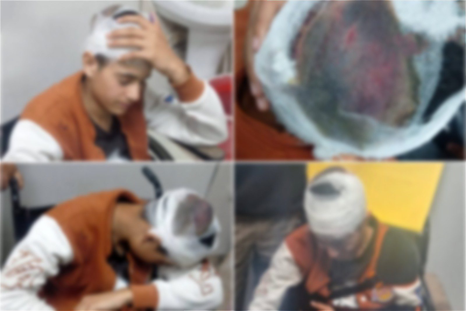 18-Year-Old Kashmiri Boy Beaten With Iron Rods in Uttarakhand, Suffers Fractures and Head Injuries